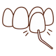 Veneers